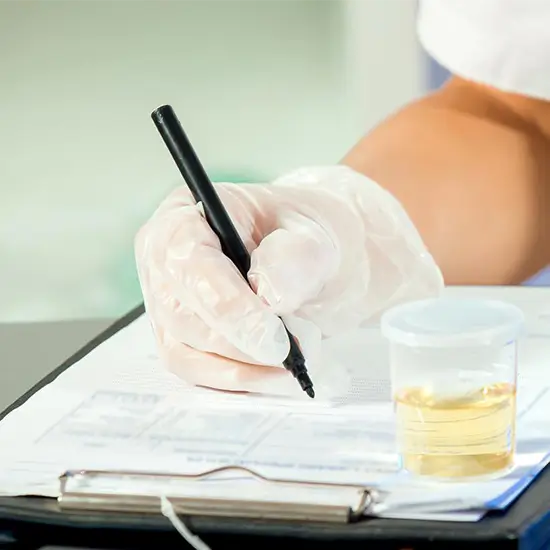 opiates screen, random urine test